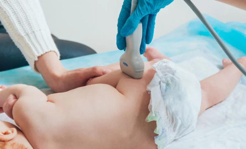 Hip Dysplasia